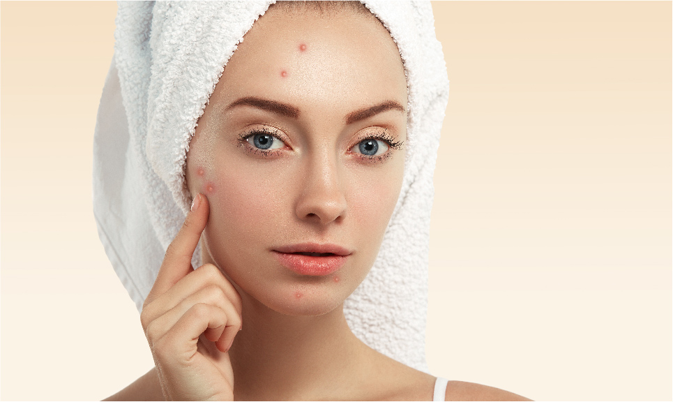 Acne Explained: Causes, Triggers, and How to Build a Clear Skin Routine